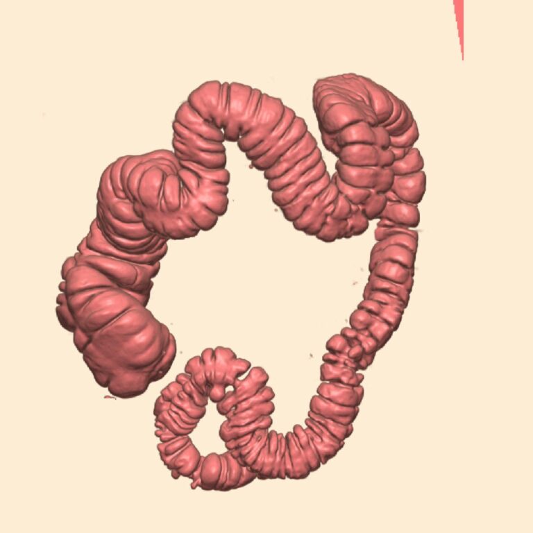 COLON 1