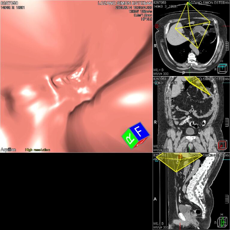 COLON VIRTIAL EXPLORACION 3 D