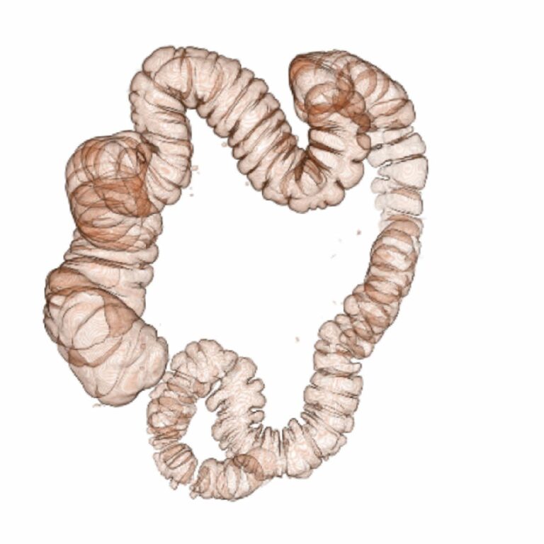 COLON VIRTUAL3