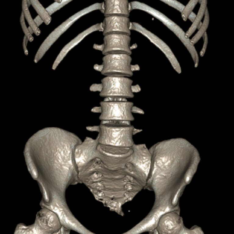 LUMBAR