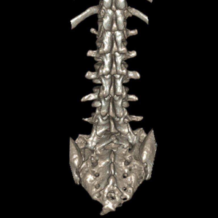 LUMBAR3