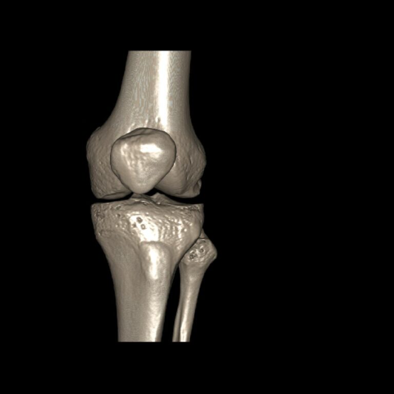 RODILLA1