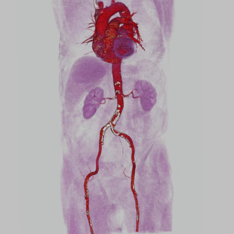 cidyt2